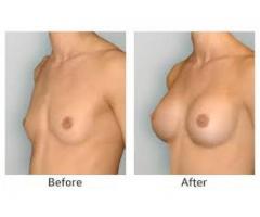 breast lift no matter how you call it difficult call mamaafica +27781179078