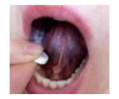 +27788702817 LEGAL ABORTION CLINIC IN ANGOLA CALL DR. LUCIA { PILLS 4 SALE } WHATSAPP