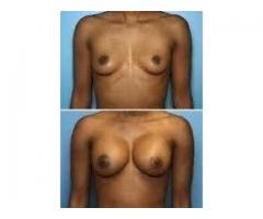 Breast Bums Hips Things Enlargement Cream Oil pills UK,USA Canada +27797661111