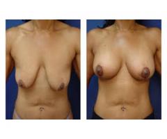 Hip, Bum And  Breasts Enlargement  Pletermaritzburg +27737922059