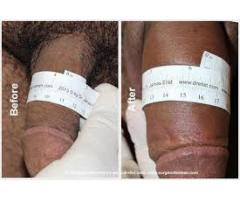 entengo herbal penis enlargement products +27735482823 in bloemfontein