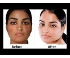 Pure 100% Skin lightening cream products  +27710566061 mamazamu SOUTHAFRICA,ASIA,NEWYORK,CANADA