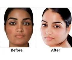 Bleaching Skin products that works effectively+27710566061 in Johannesburg, Durban, Pretoria