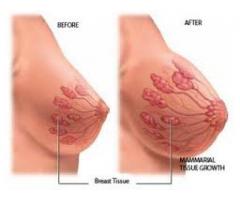 Southafrica Breast Enlargement Creams and Pills - Breast Enlargements+27630716312 Prof.mamaalphah