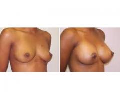 Yodi and Botcho Breast,Hips,Bums Enlargemet cream & Tummy reductions+277737155151 S.a,USA